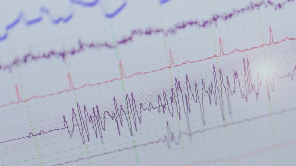etisense-signals-monitoring