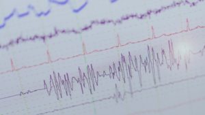 etisense-signals-monitoring